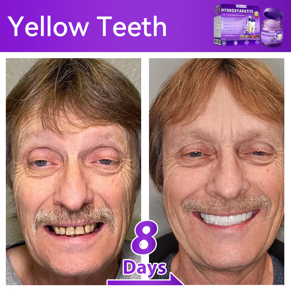 🎉 New Year Special: 80% OFF 💕 Dormorna® Hydroxyapatite Tooth Restorative Powder 🦷 - Image 3