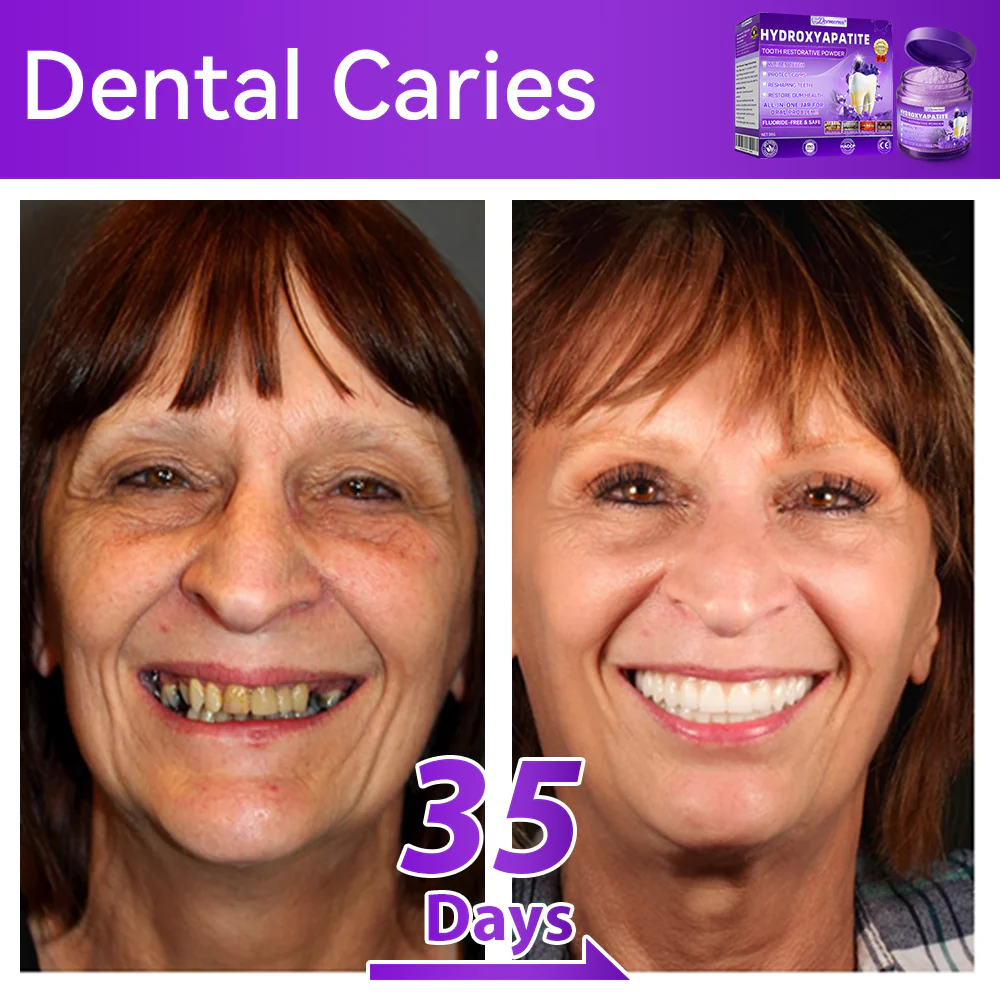 🎉 New Year Special: 80% OFF 💕 Dormorna® Hydroxyapatite Tooth Restorative Powder 🦷 - Image 4