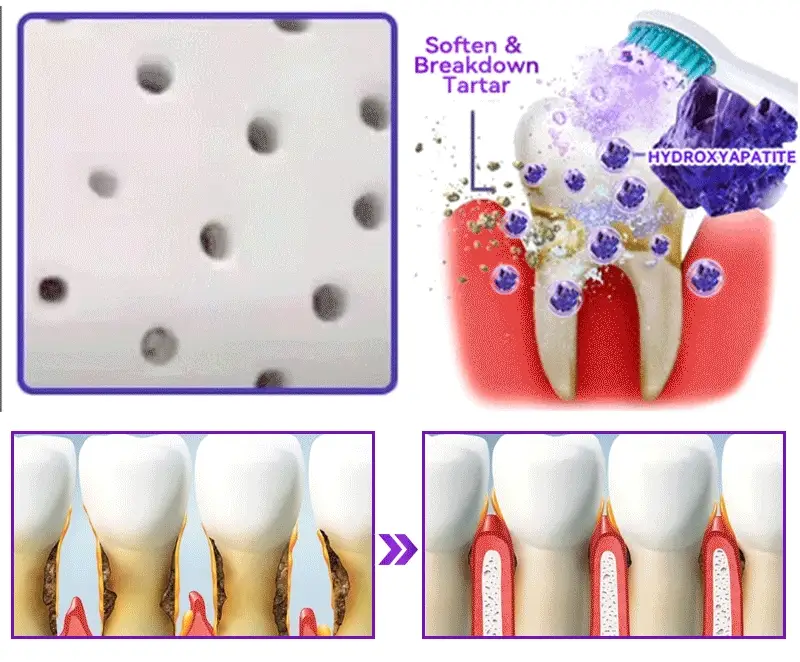 🎉 New Year Special: 80% OFF 💕 Dormorna® Hydroxyapatite Tooth Restorative Powder 🦷 - Image 6
