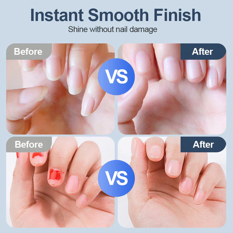 🌏🌏Universal Automatic Fingernail Grinder - 6 Speed Settings with 5 Attachments for Safe & Gentle Nail Care 💅✨ - Image 2